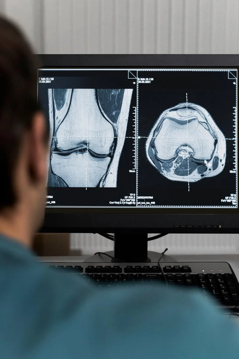 Traumatología y fracturas en Monterrey